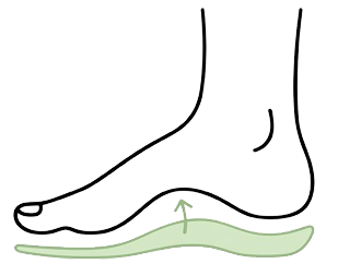 high_arc_feet_recoverey_sandal_kyro